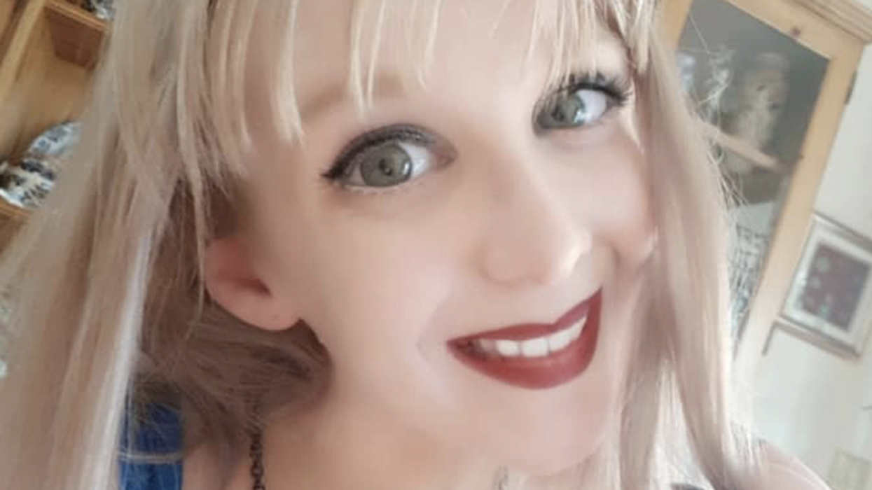 Woman Who Risks Internal Decapitation Due To Rare Condition Hopes To Raise Money For Life-Saving Surgery