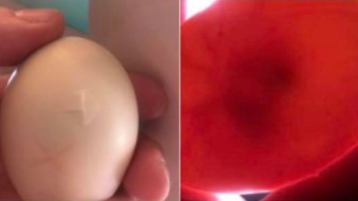Woman Hatches Duckling After Finding Cracked Egg And Incubating It In Her Cleavage For 35 Days