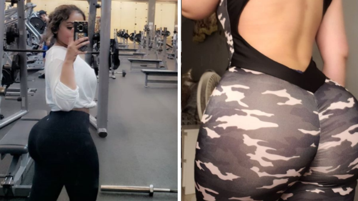 Instagram Model Whose Butt Lift Was Botched Says She Was Unable To Sit For Six Months