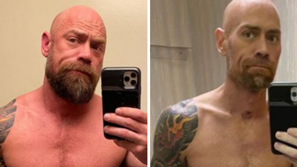 Man's Before And After Pictures Capture The Devastating Toll The Virus Took On His Body After Six Weeks In The Hospital