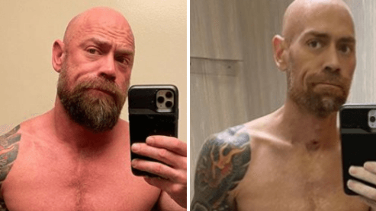 Man's Before And After Pictures Capture The Devastating Toll The Virus Took On His Body After Six Weeks In The Hospital