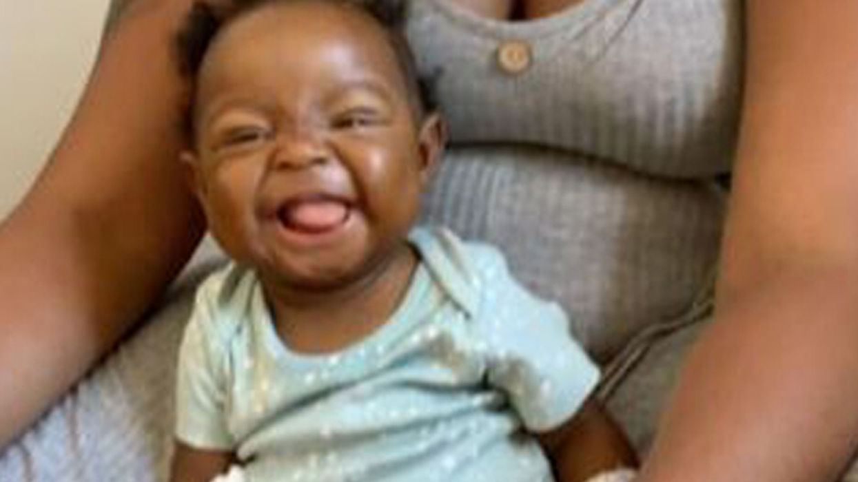 Mom Fears Her 16-Month-Old Daughter With Rare Liver Condition May Need Second Liver Transplant