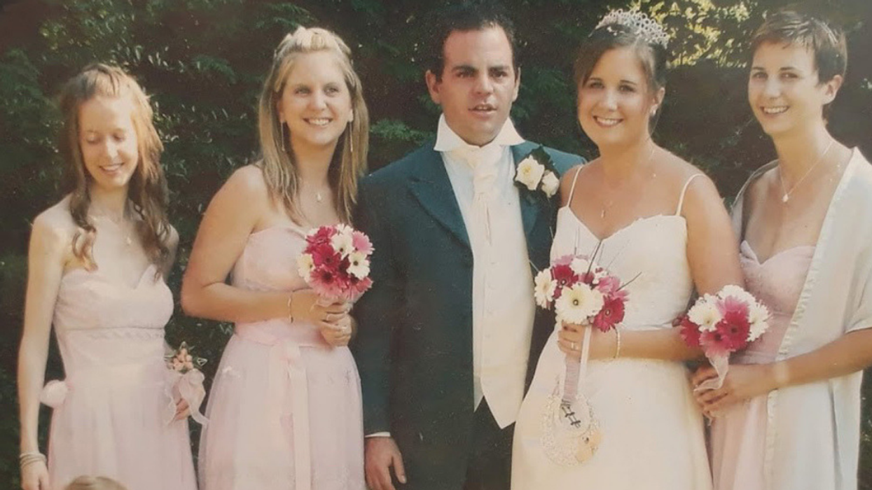 Mom Has No Recollection Of Her Wedding Day Or Giving Birth After Rare Brain Bug Wipes Her Memory