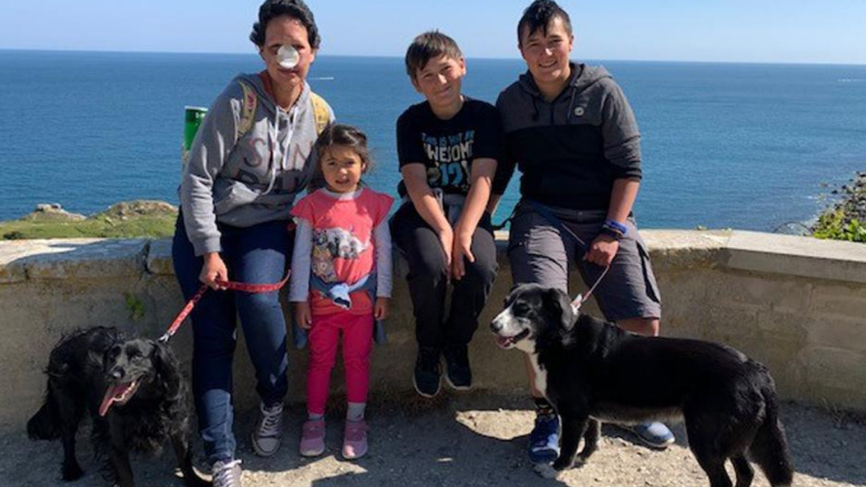 Mom Who Had Nose Removed Due To Aggressive Cancer Seeks Donations To Fund Dream Wedding