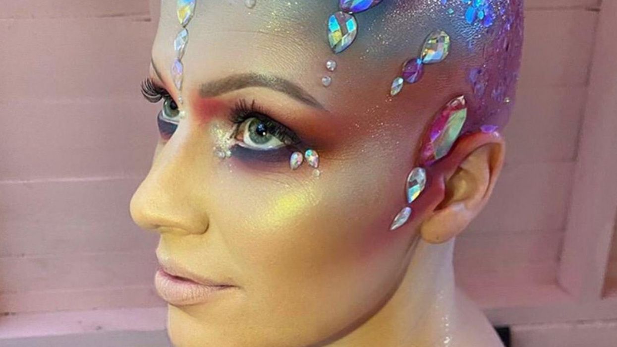 Woman Who Lost Her Hair To Alopecia At 17 Ditches Her Wig To Show Off Her Beautiful Bald Head On Instagram