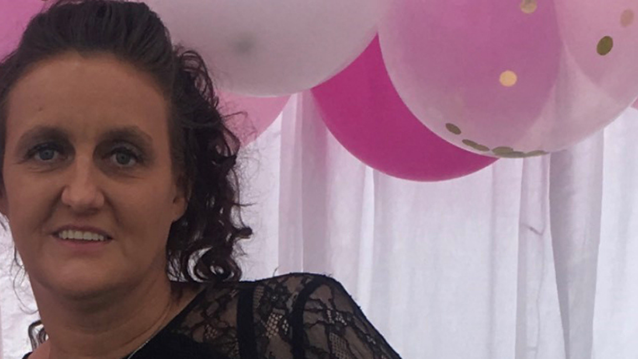 Woman Opens Up About Having Half Of Her Ear Bitten Off When She Attempted To Break Up A Fight