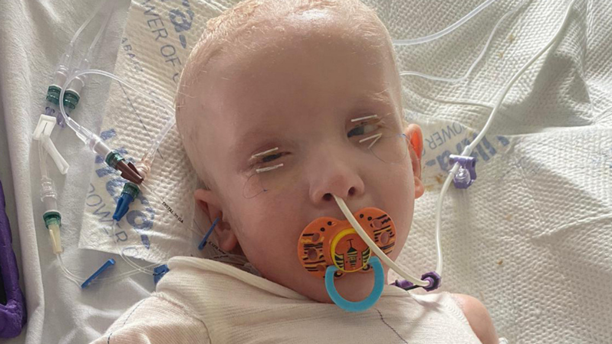 Doctors Warn Mom Her Son Might Not Survive After Rare Condition Causes His Skin To 'Slide Off'
