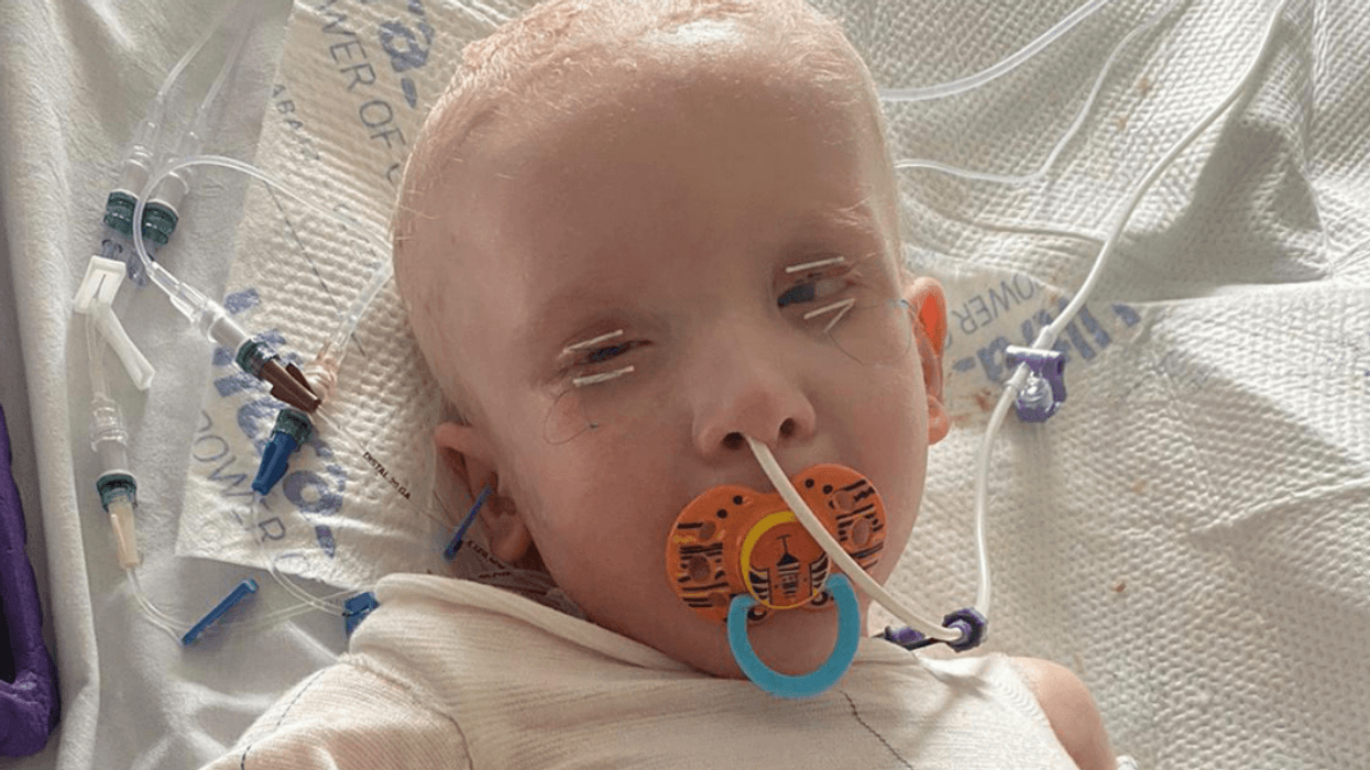 Doctors Warn Mom Her Son Might Not Survive After Rare Condition Causes His Skin To 'Slide Off'