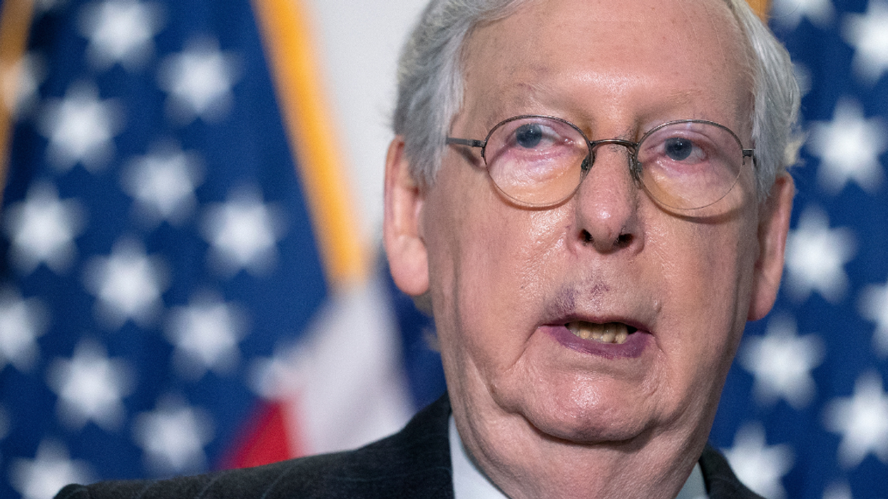 Mitch McConnell Continues To Deny Any Health Issues Despite Having An Obviously Bruised Face And Hands