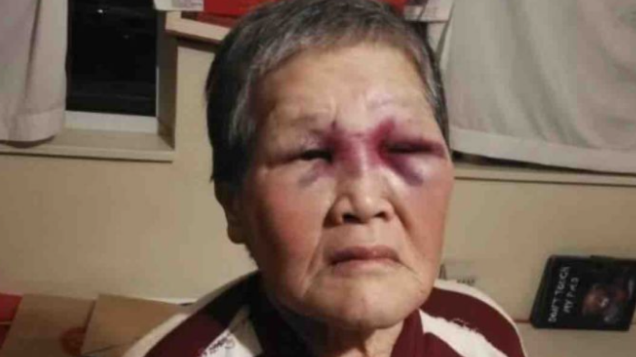 Asian Grandma Attacked In San Francisco Plans To Donate $900k Raised For Her To 'Combat Racism'