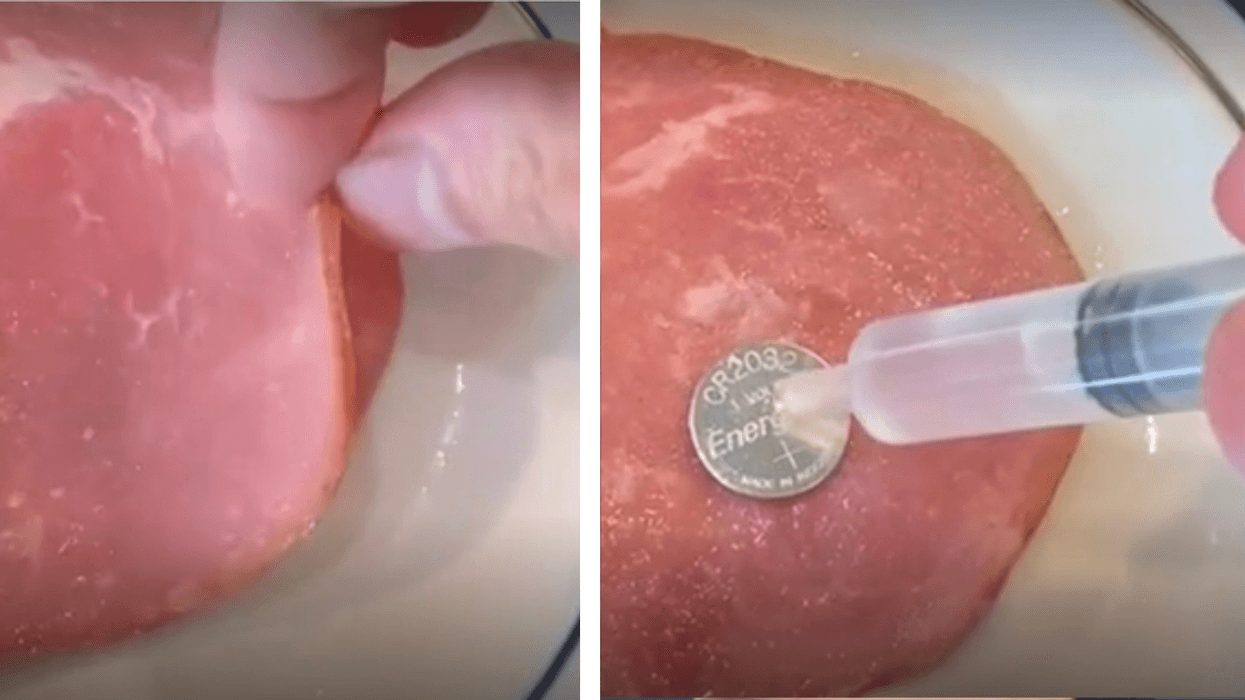 TikTok Doctor Shows What Swallowing A Battery Can Do To Your Body In Eye-Opening Video