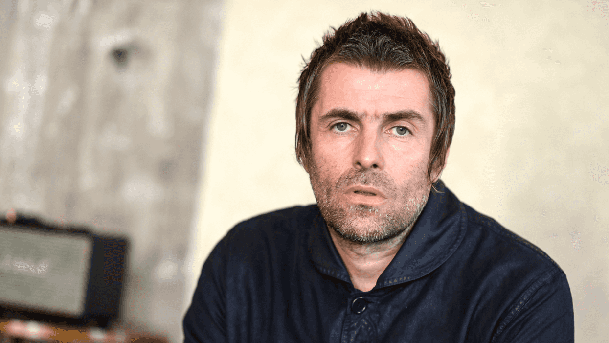 Oasis Frontman Liam Gallagher Posts Photo Of His Banged Up Face After Falling Out Of Helicopter