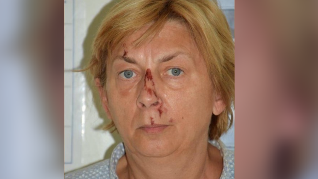 Authorities Find Woman On Rock Off Coast Of Croatia—And She Has No Idea Who She Is Or How She Got There