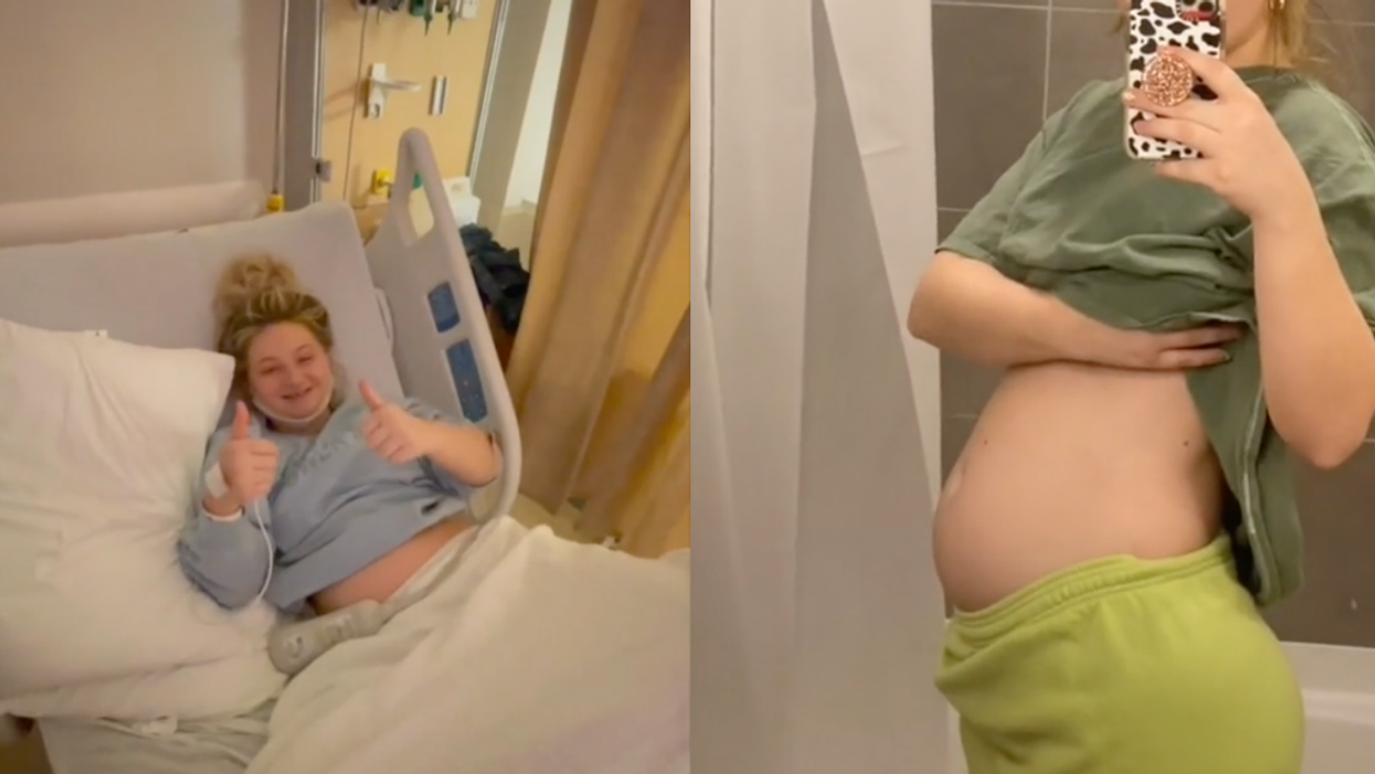 Woman Who Gained 50 Pounds In Three Months Says Doctor Told Her It Was Just 'Psychosomatic'