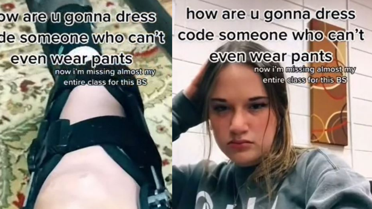 Teen Forced To Miss Class Because Shorts She Wore To Accommodate Leg Brace Violated Dress Code