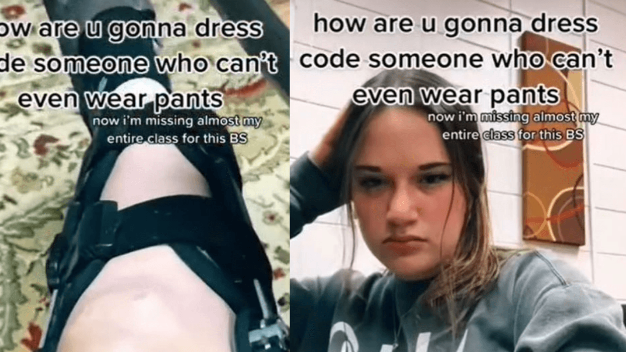 Teen Forced To Miss Class Because Shorts She Wore To Accommodate Leg Brace Violated Dress Code