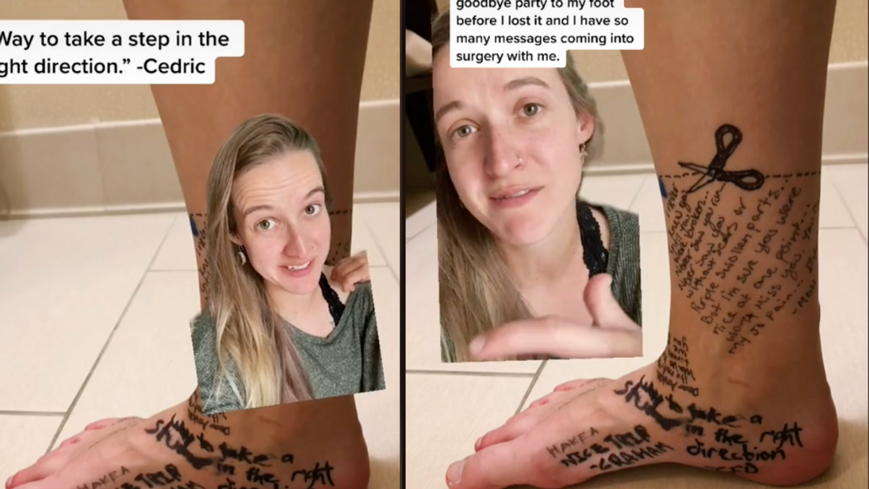 TikToker And Her Friends Write Goodbye Messages To Her Foot Before She Has It Amputated