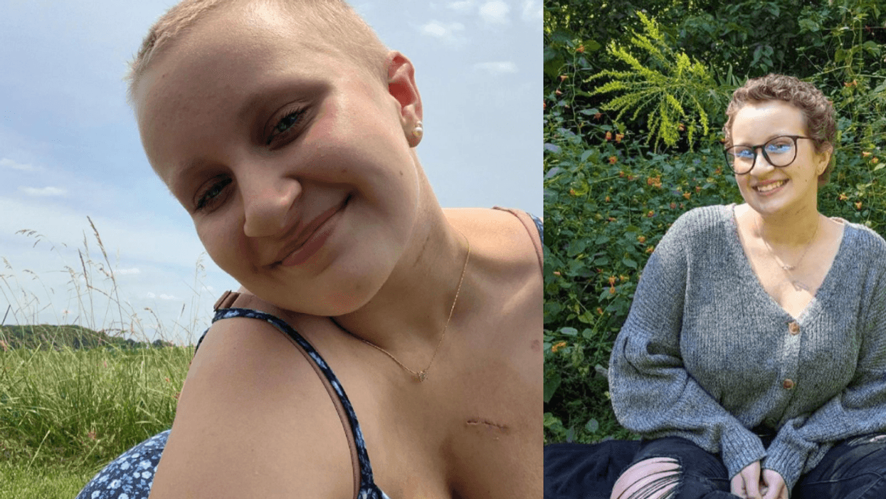 Teen Cancer Survivor Devastated After Her Chemotherapy Port Scar Was Edited Out Of Yearbook