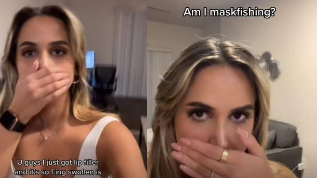 TikToker Stunned After Swelling From Lip Filler Treatment Makes Her Look Like 'The Grinch'