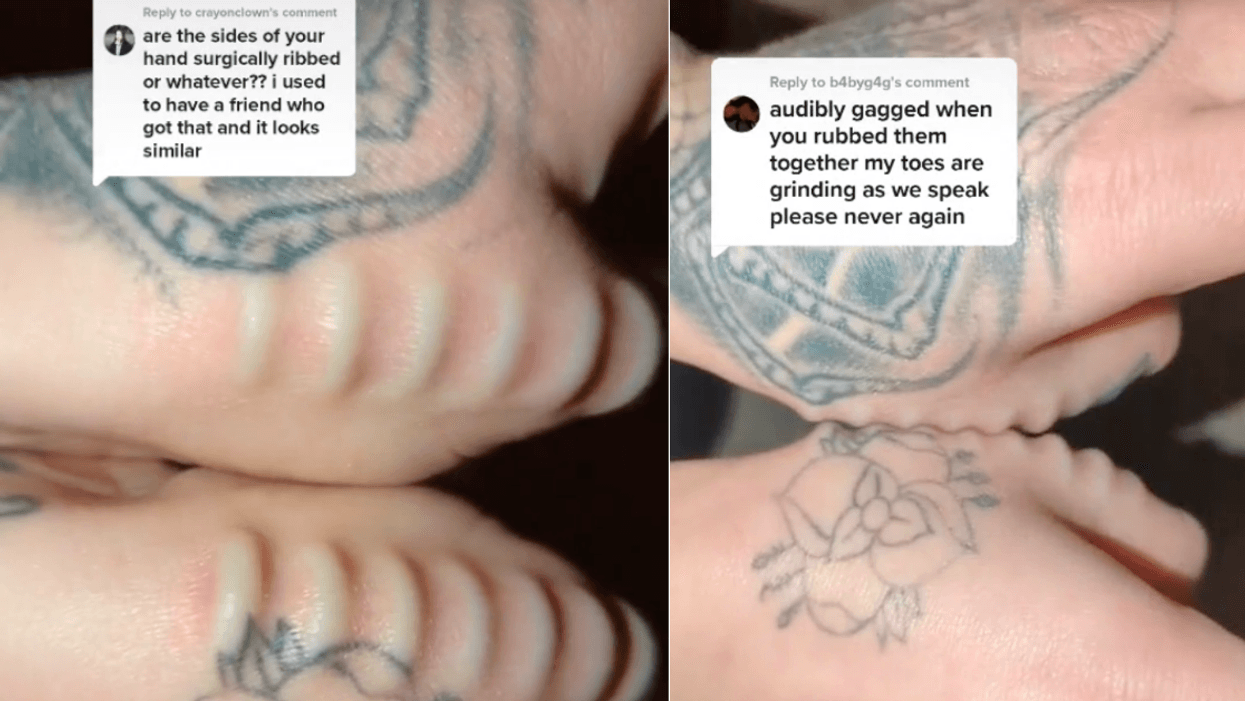Woman Shows Off Silicone Implants On Her Thumbs She Rubs Together Like A 'Weird Fidget Toy'