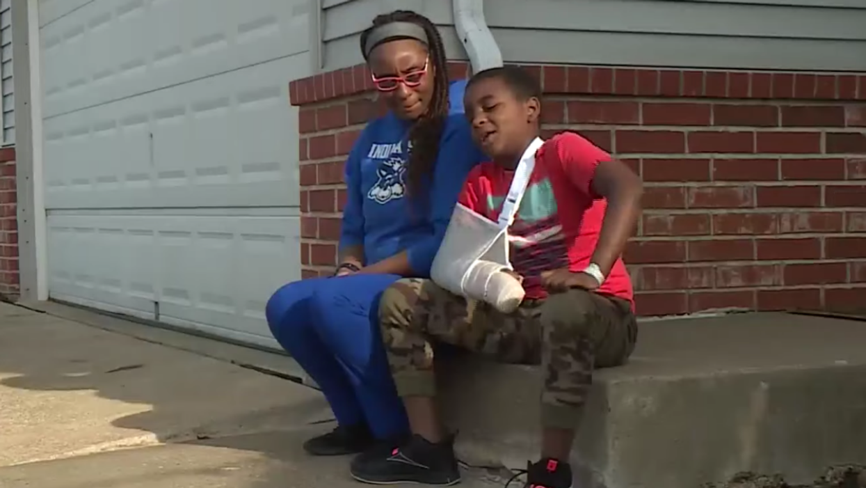 Missouri Family Blasts School For Not Calling 911 After 9-Year-Old Boy Lost Finger Due To Fall