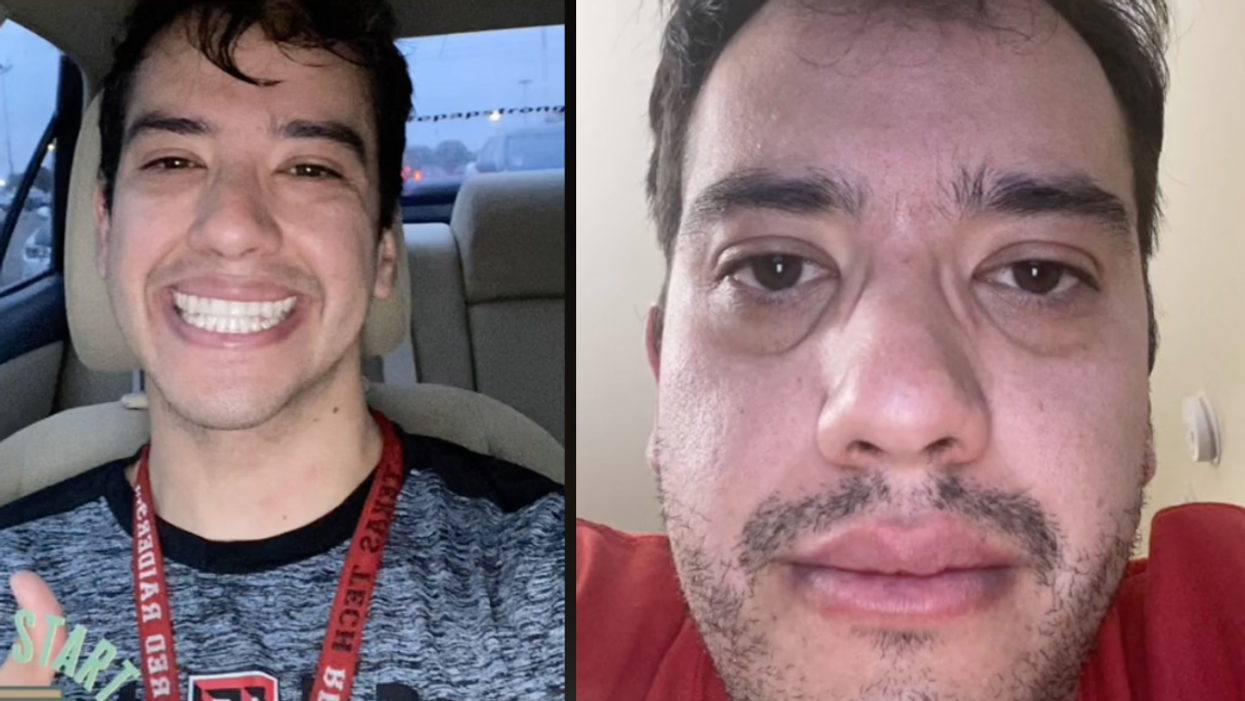 Med Student's Before And After Photos Show The Noticeable Toll It's Taken On His Appearance