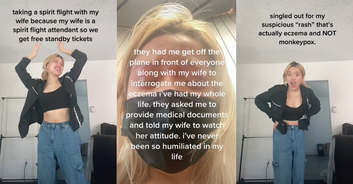 TikToker Escorted Off Plane After Flight Attendant Mistook Their Eczema For Monkeypox