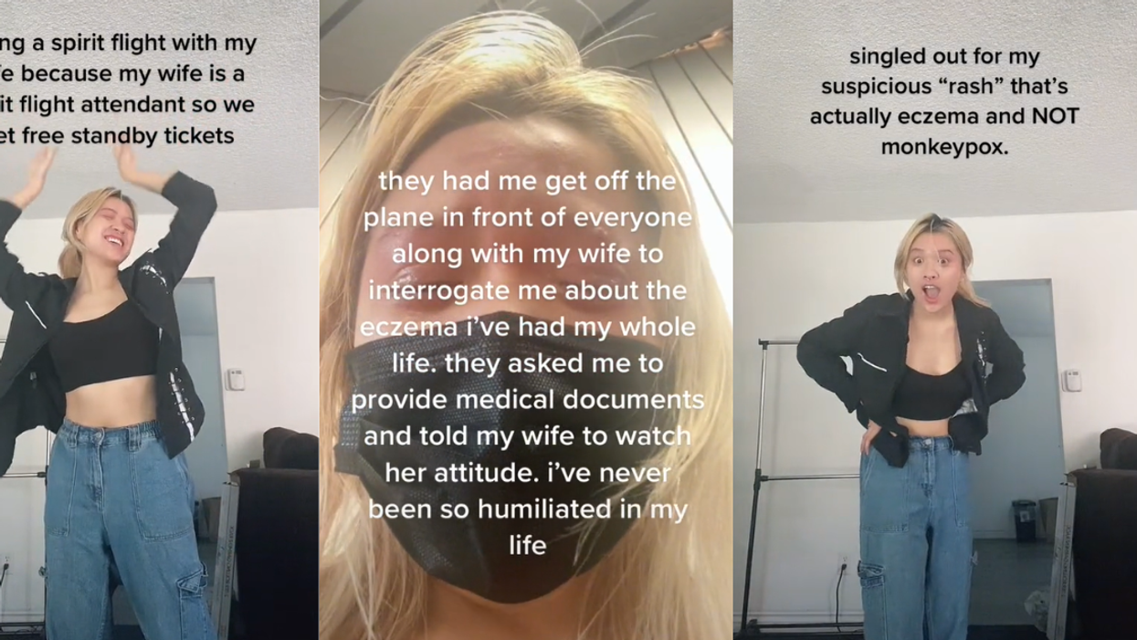 TikToker Escorted Off Plane After Flight Attendant Mistook Their Eczema For Monkeypox