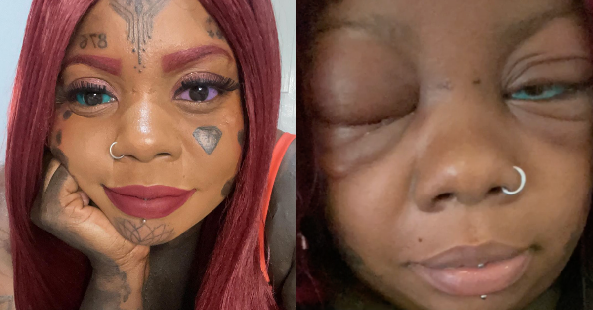 Mom Decided To Tattoo Her Eyeballs Blue And Purple—And Now She's Losing Her Vision
