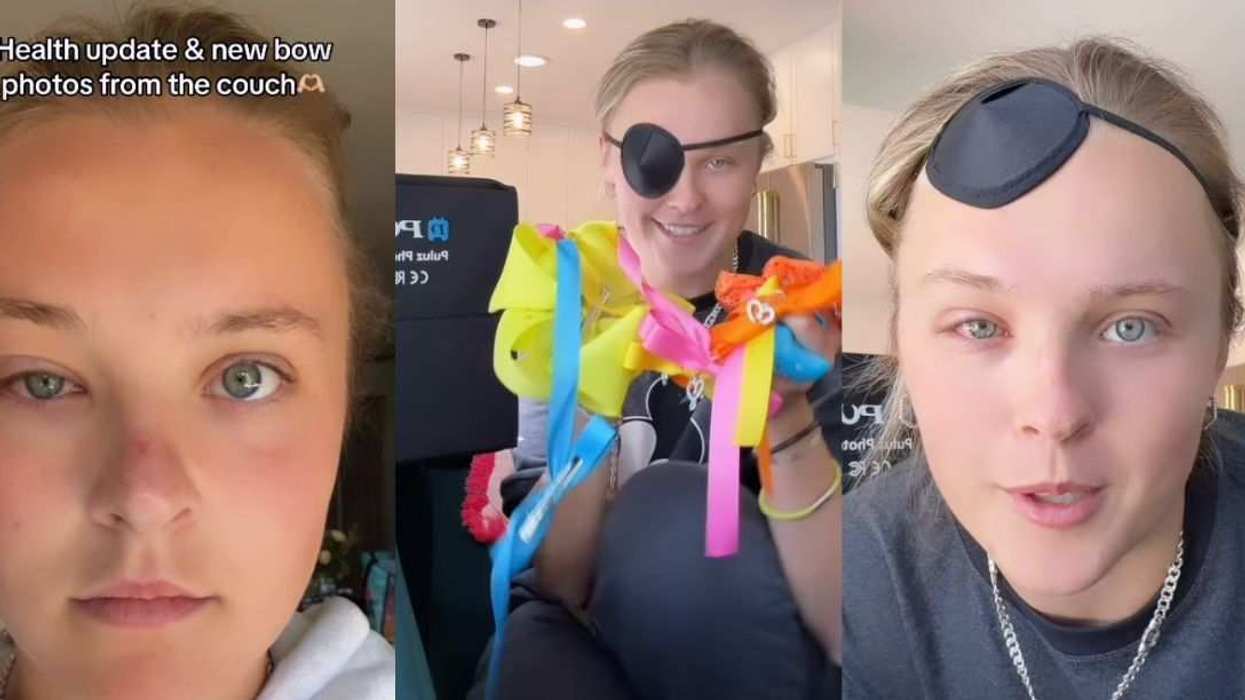 JoJo Siwa shared a health update after suffering a concussion and eye infection following a golf cart accident.
