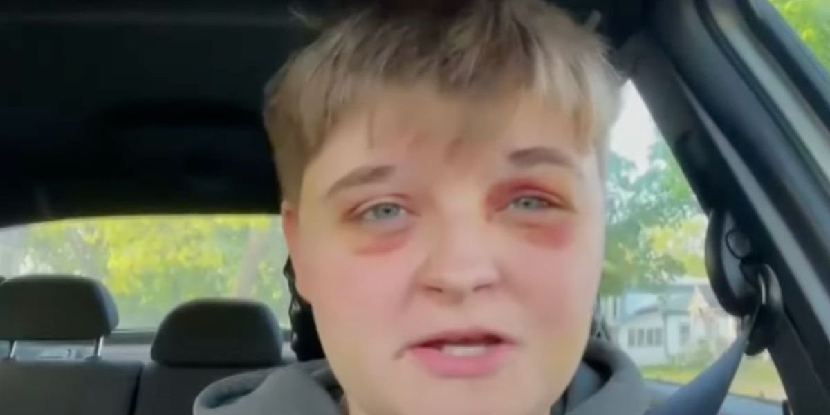 Lesbian Speaks Out After She Was Beaten Unconscious For Entering Illinois McDonald's Bathroom
