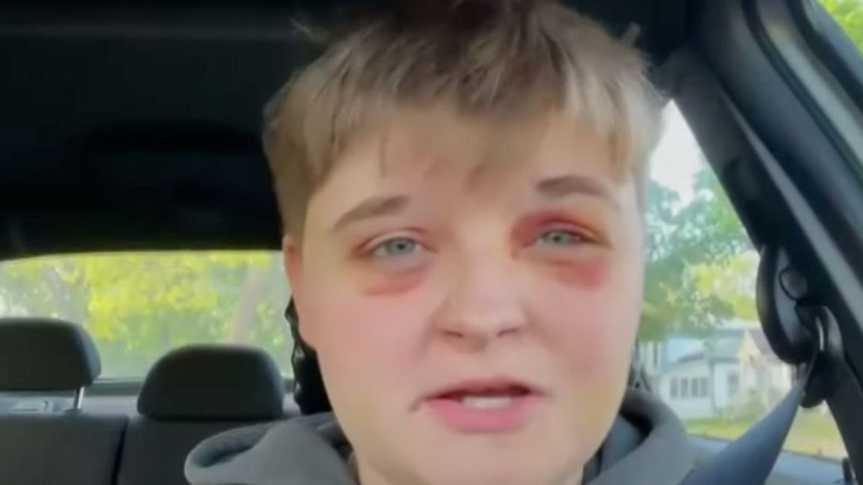 Kady Grass is recovering from a violent hate crime attack that took place in Carpentersville, Illinois