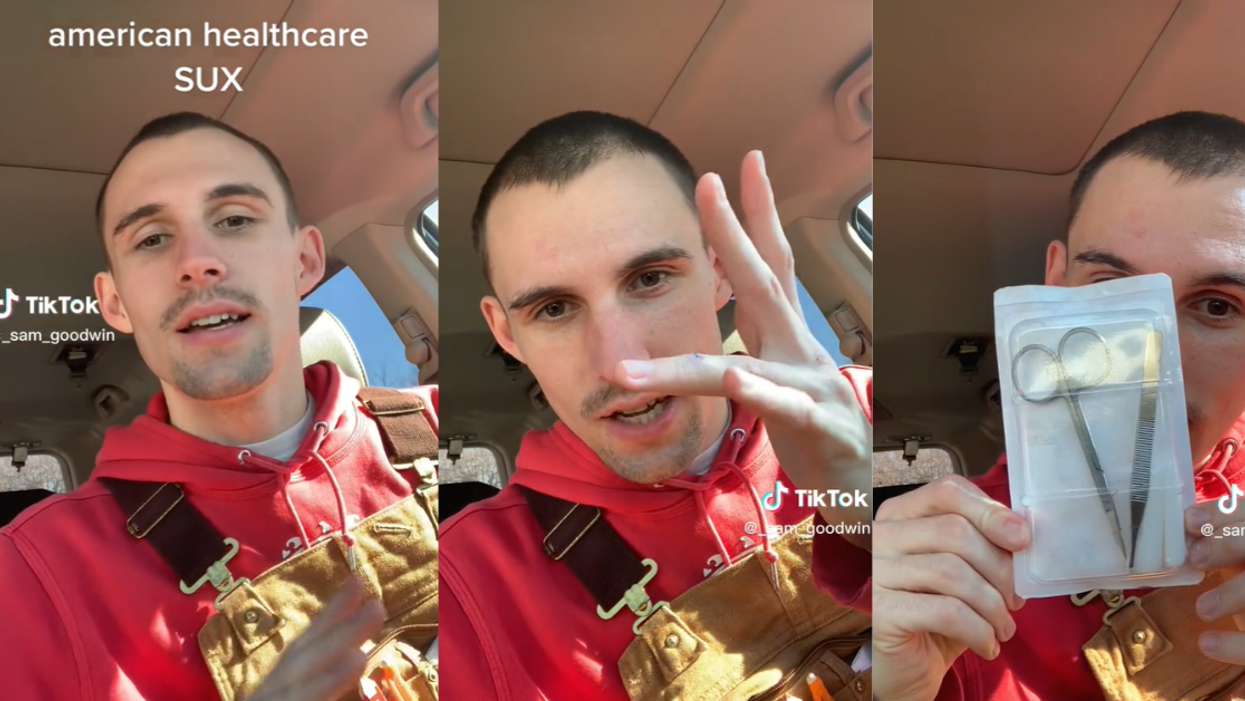 Man details the multiple costs of getting stitches and having them removed with the U.S. Healthcare system.