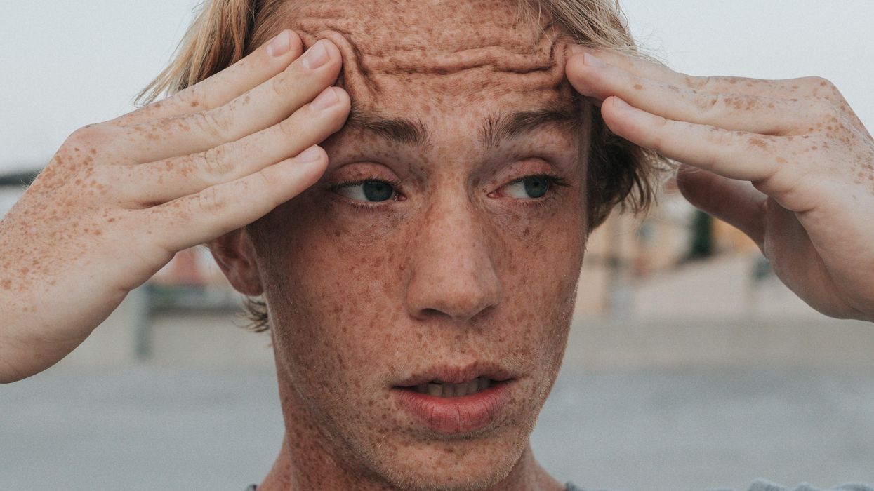 Man rubbing his forehead