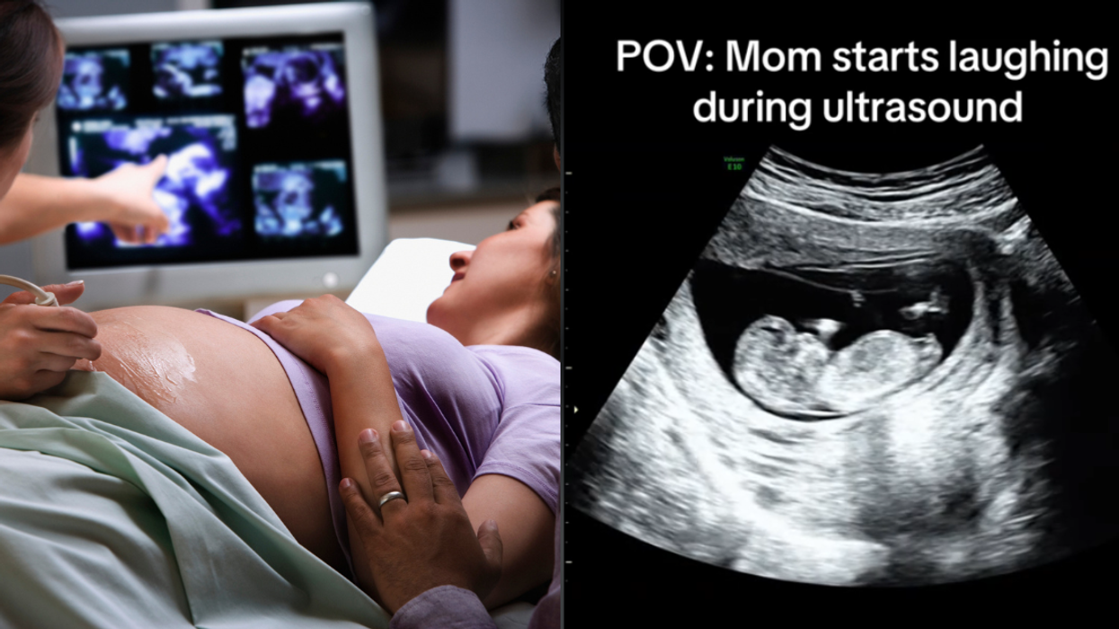 Mother-to-be looking at screen during ultrasound; Screenshot from @peekatbaby4d's TikTok video