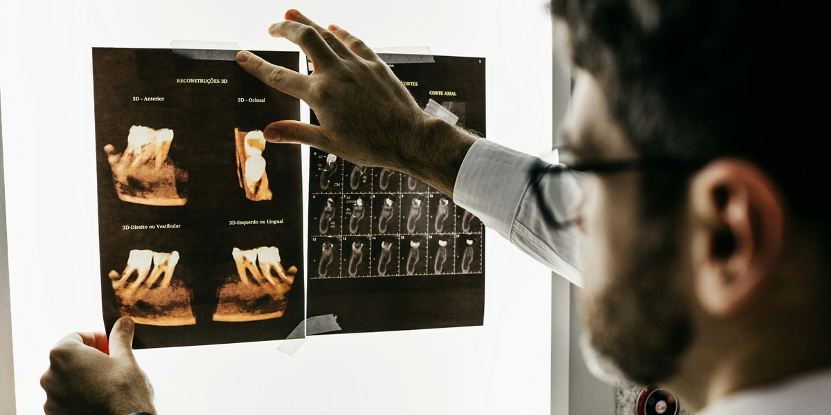 person looking at x-rays of teeth