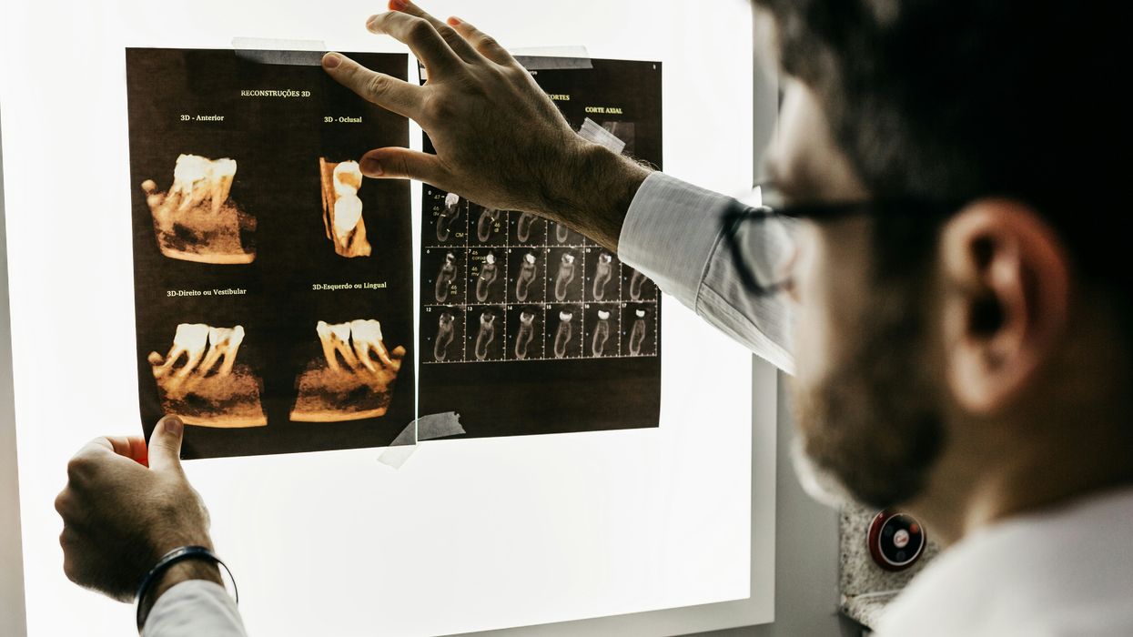 person looking at x-rays of teeth