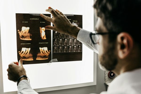 person looking at x-rays of teeth