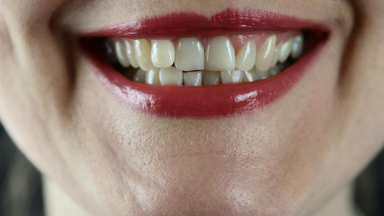 People Who Won The Genetic Lottery Break Down Their Best Qualities