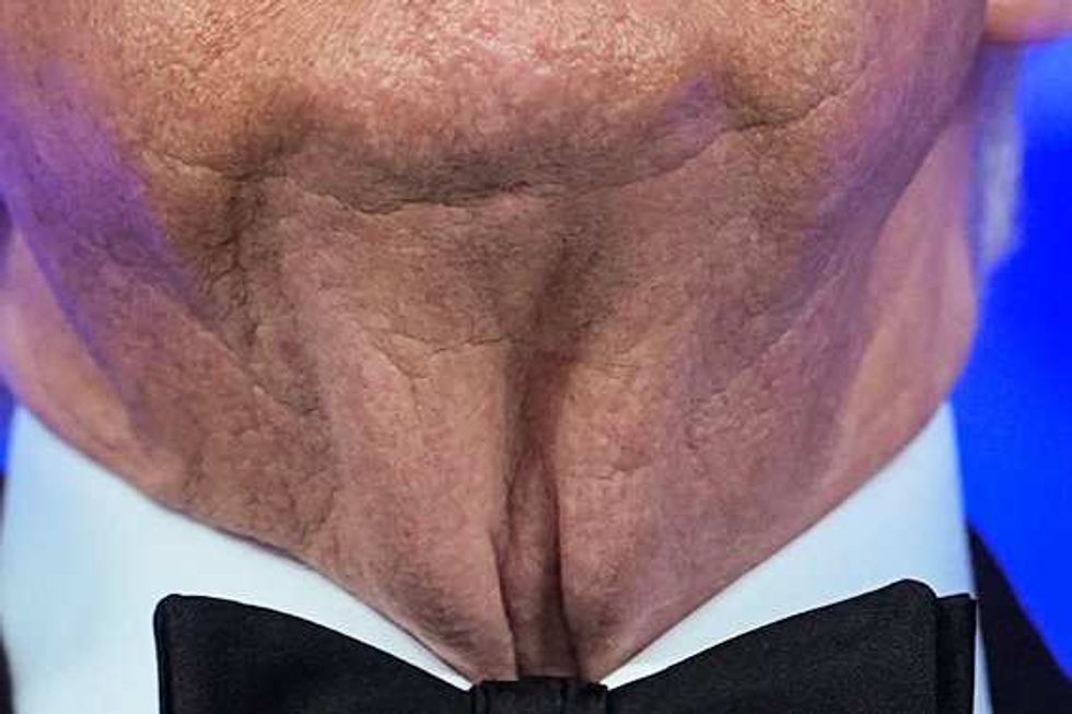 Screenshot of Trump's neck
