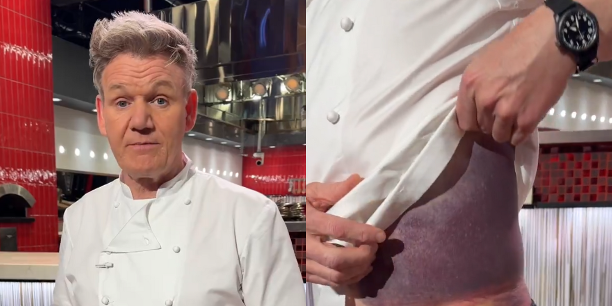 Gordon Ramsay 'Lucky To Be Here' After Bike Accident VIDEO Comic Sands