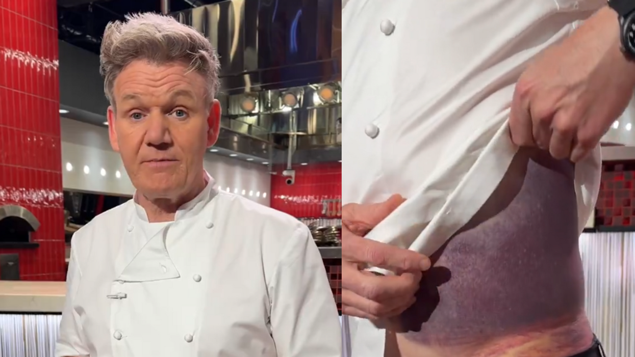 Screenshots of Gordon Ramsey and his biking injury
