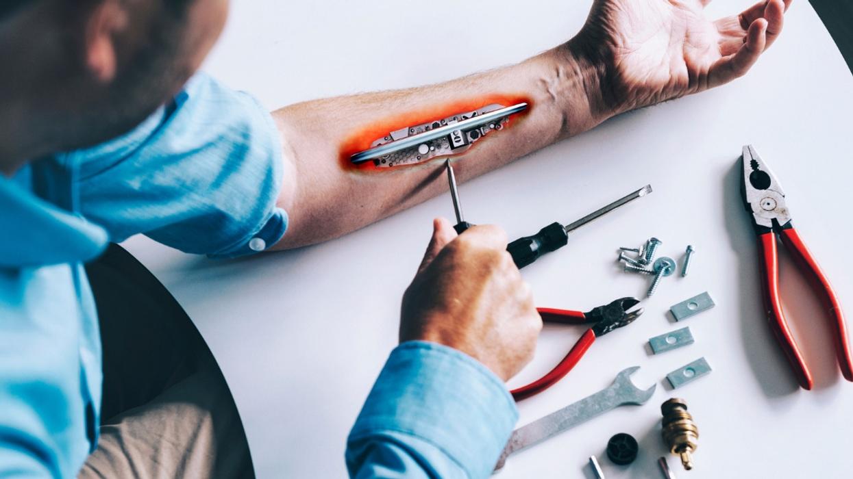Man's Photoshoot Showcasing His Robotic Arm Is Going Viral—And We Can See Why
