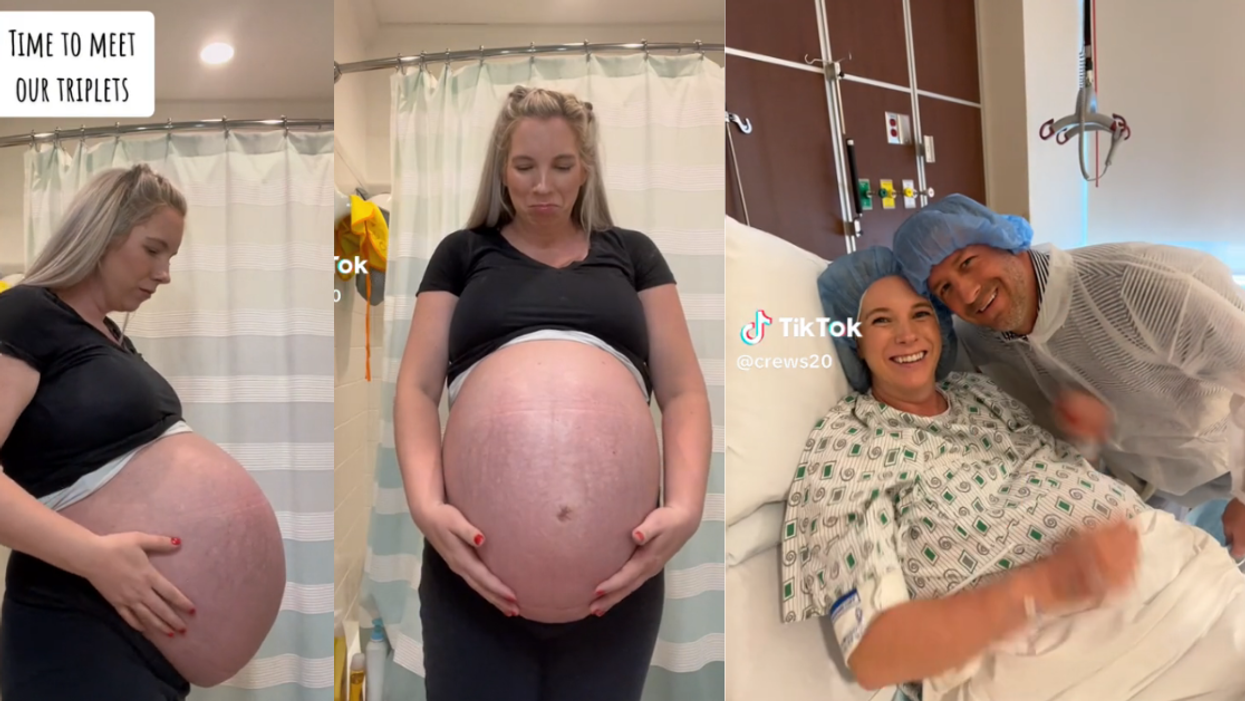 Woman preparing to deliver triplets