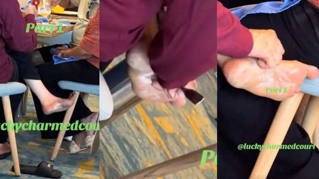 Woman scraping foot fungus with cruise ship buffet fork