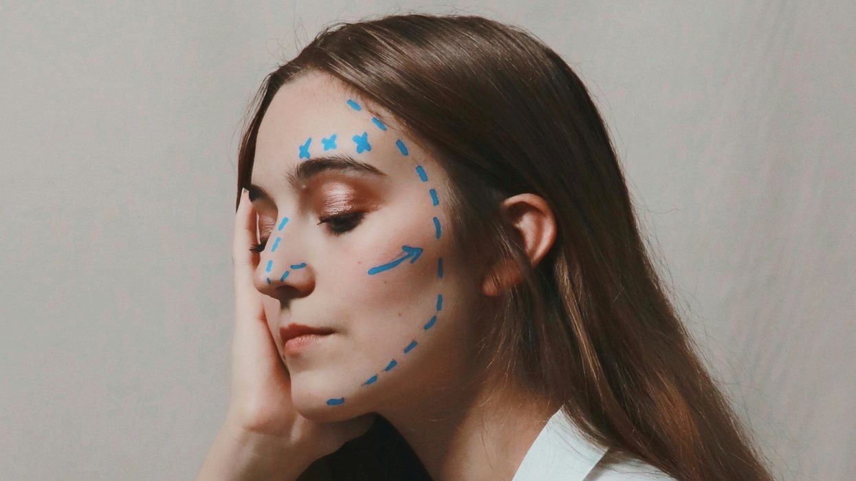 Woman with pre-plastic surgery facial markings