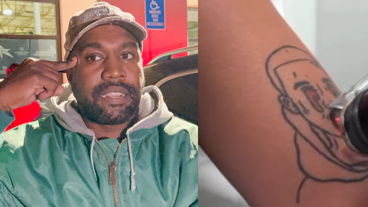 Ye; tattoo of Ye being removed